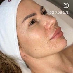 Tretmani lica Novi Sad