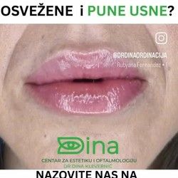 Lepe i pune usne sa potpuno prirodnim izgledom