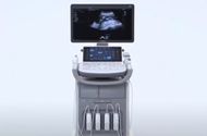 5D ultrazvuk- čudo tehnologije u ginekološkim ordinacijama