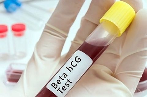 Test na Beta HCG najpouzdaniji test za dokazivanje trudnoće možete uraditi u laboratoriji