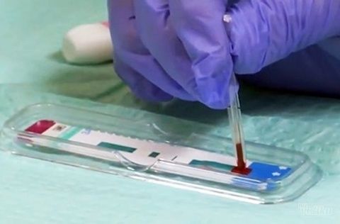 Testiranje na HIV u laboratoriji