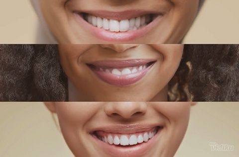Šest namirnica koje bi trebalo da koristite za lepši osmeh