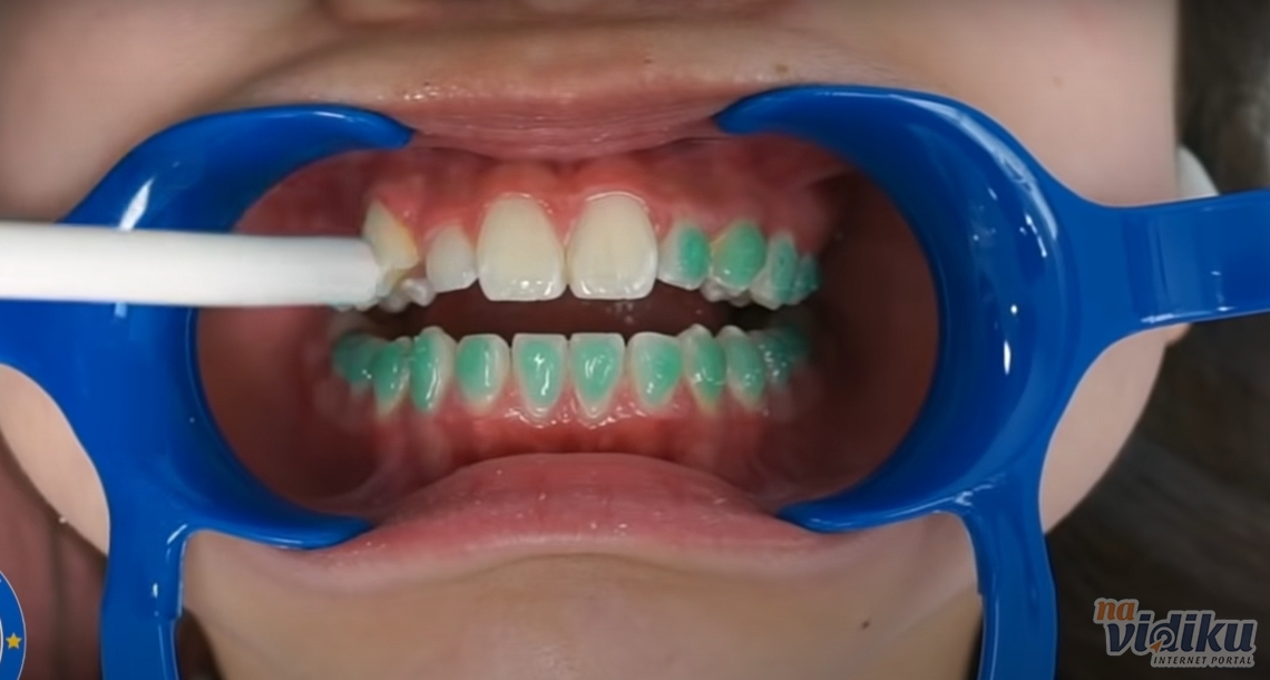 Da li imate zdrave zube?