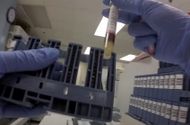 Pripremite se za laboratorijske analize