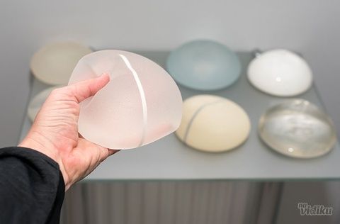 Anatomski ili okrugli implantati