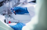 Proverite zdravlje u najboljim laboratorijama Beograd