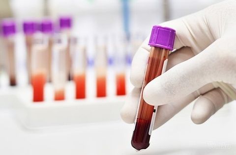 Važnost laboratorijskih analiza